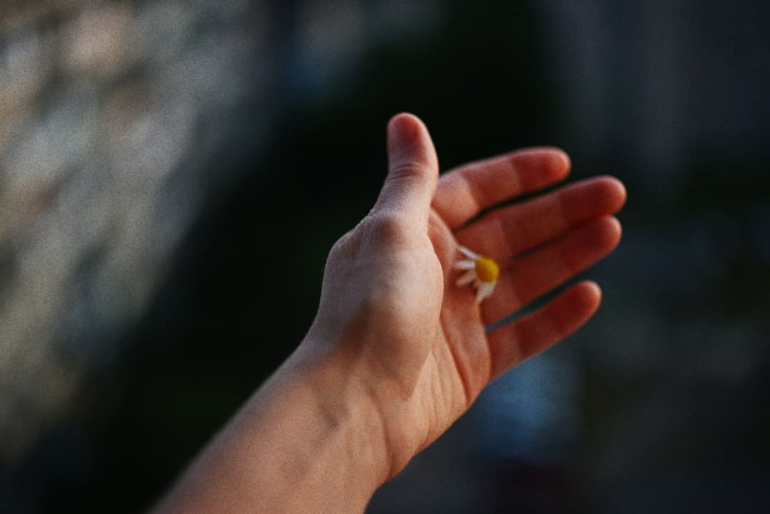 搞笑女艺人自曝花79万整容:期望更美丽的脸日子
